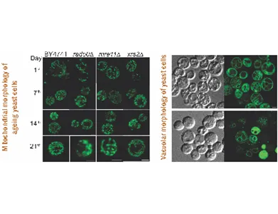 Confocal microscope images of mitochondria and vacuoles in ageing yeast cells
